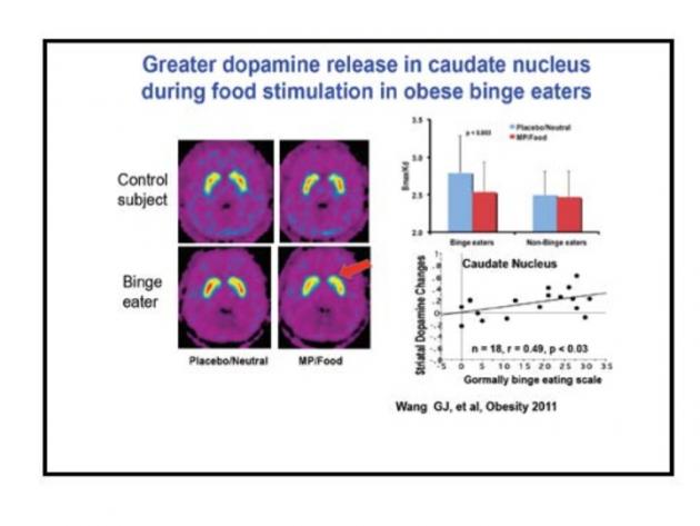 Binge Eaters Have Greater Dopamine Release