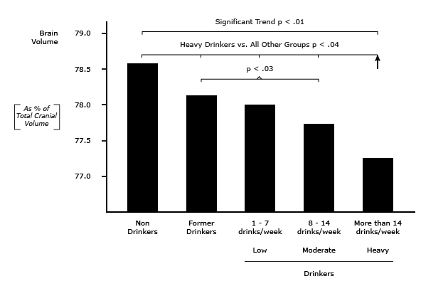 Alcohol Drinking is Associated with Reduced Brain Volume.